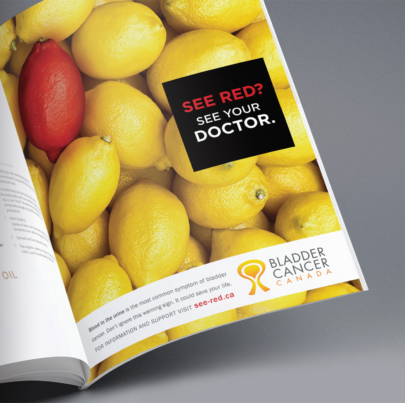 Bladder Cancer Canada campaign full-page magazine ad laid open on a table